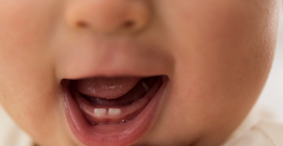 dental blog 12
