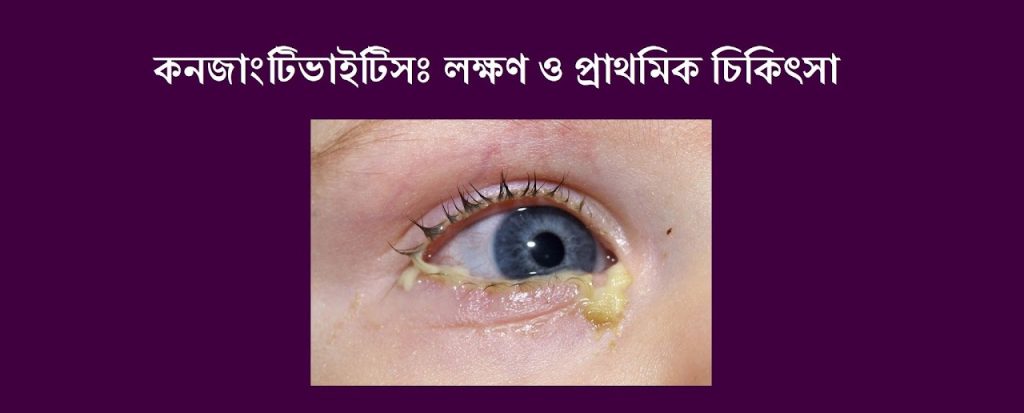 conjunctivitis