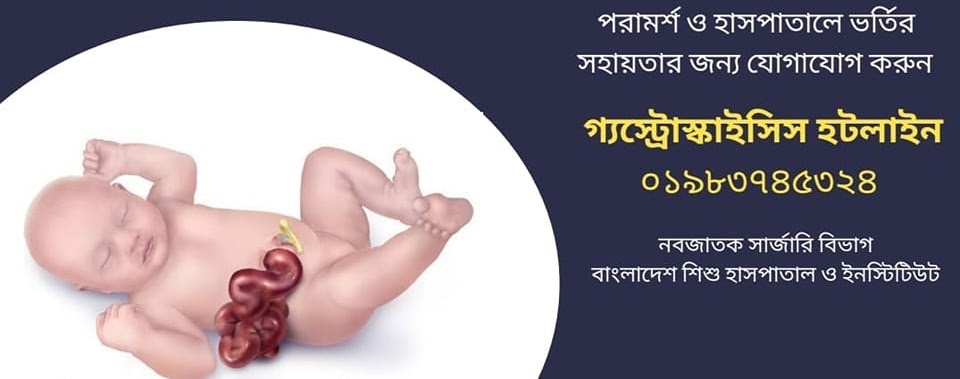 gastroschisis